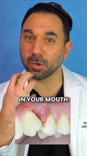This Tooth Problem Stops Orthopedic Surgeons In Their Tracks #facts #teeth