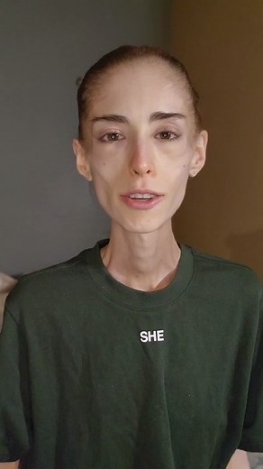 Refeeding Syndrome. Remember, I'm not a doctor. Please seek medical care if you are experiencing any symptoms. 🐺🌸⚔️ - - - - - #recoveryispossible #fyp #breakfree #mentalhealthawareness #mentalhealthmatters #mentalhealth #relationships #recovery #mentalhealthtiktok #recovery #recoverytok #fypシ #relateable #wieiadedrecovery #refeedingsyndrome