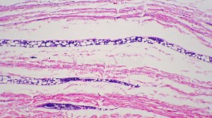 Microscopic 100x View of Human Skin with Shown Sweat Glands Against Bright Field Stock Video - Video of microbiology, duct: 254358111