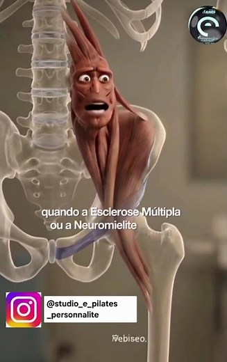 Iliopsoas : músculo flexir do quadril