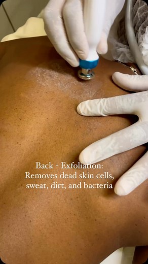 2.3K views · 26 reactions | This reduces acne by decreasing the...