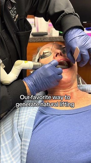 The Fotona laser for facial rejuvenation 👏🏼