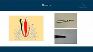 Exodontics - Tooth Extraction in cats and dogs