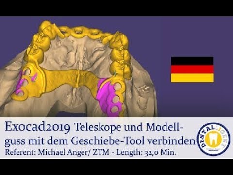 Exocad 2019 Tutorial preview - Teleskope und Modellguss mit dem Geschiebe-Tool verbinden