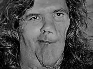 Riverside Resident Struggles With 'Elephant Man' Syndrome