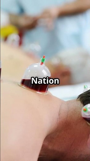 Discover the Benefits of Hijama!