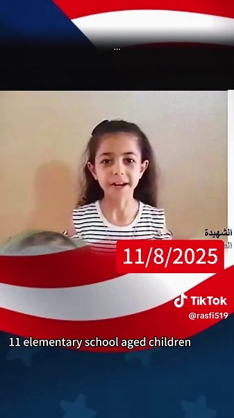 From Trauma to Transformation: My Nose Job Journey & Mental Health Story #MentalHealth #PlasticSurgery #nosejob #storytime #bodyimage #story #fyp #foryou #medicine #therapy #healthcare #trauma #miaschem #tiktok #viral #edwardmliger #fypシ #pov