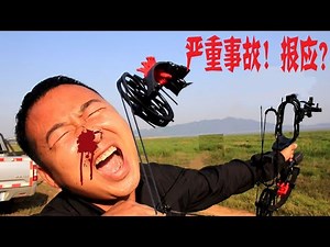 小伙试用能射钢珠的复合弓，发生严重后果损失惨重 Compound bow accident
