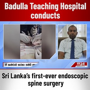 Badulla Teaching Hospital conducts Sri Lanka’s first-ever endoscopic spine surgery | Ada Derana | Facebook