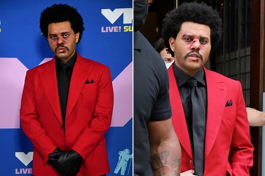 What happened to The Weeknd’s face? Why he was bloody at the VMAs