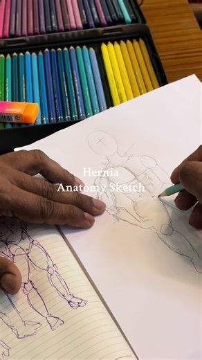 Direct Inguinal Hernia and Indirect Inguinal Hernia #anatomyart #anatomy #hernia #fyp #srilanka