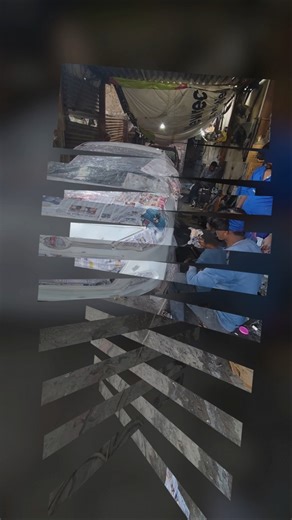 i20 denting painting work | #music #trending #dhurandhar #fa9la