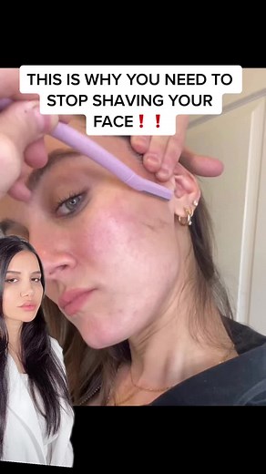 #greenscreen There are a range of common side effects, including breakouts, risk of infection, redness or discoloration, and irritation. #dermaplaning #shaving #shavingface #skincare #skincareroutine #skintok