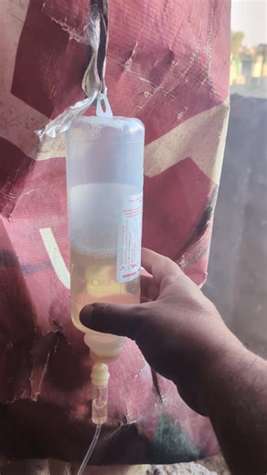 Plasma infusion in buck | anemia| iron deficiency