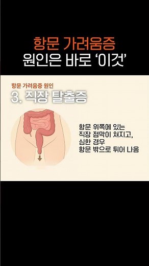 항문 가려움증, 주요 원인 4가지 🤯🌀 #항문소양증 #항문소양증원인