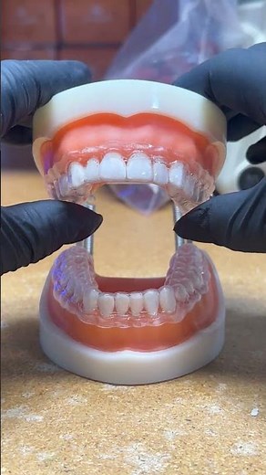 How to apply perio gel on trays