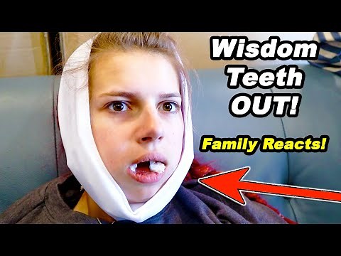 Daniell's HILARIOUS Wisdom Tooth AFTERMATH! PART2