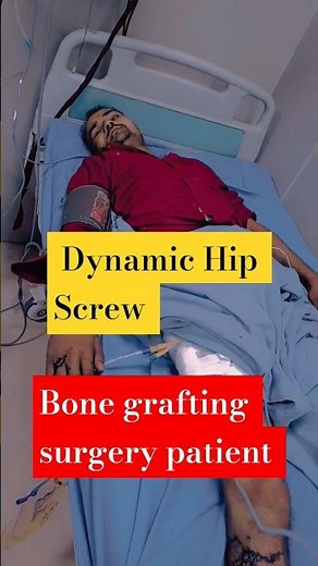 Dynamic Hip Screw with bone grafting surgery patient