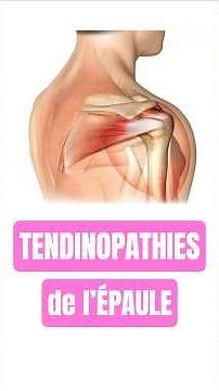 TENDINITES DE L'ÉPAULE : Exercices de renforcement. #santé #épaule #renforcementmusculaire #sport