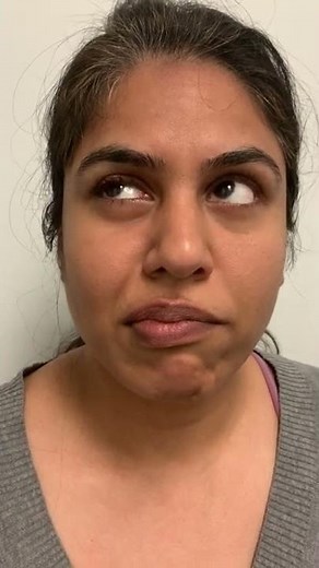 Facial Paralysis Lip Exercise