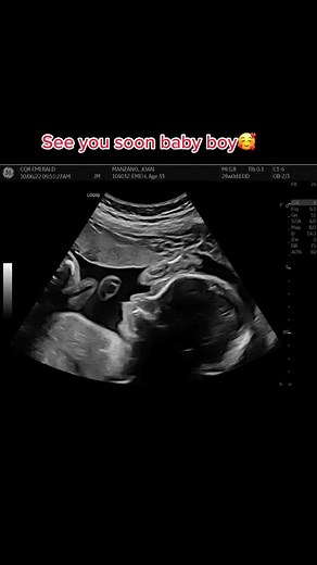 28 Weeks Pregnant Ultrasound: Baby Boy Sonar