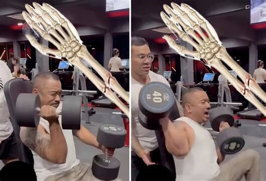 Snapped: When Doing Too Much At The Gym Goes Wrong!