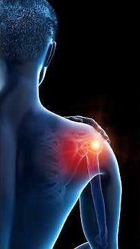 ❌ Same Pain? Different Problem! Bursitis vs Tendonitis