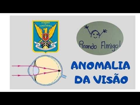 VISUAL ANOMALY