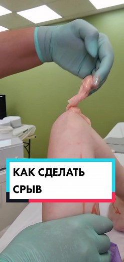 Medical Treatment Procedure on Leg Explained