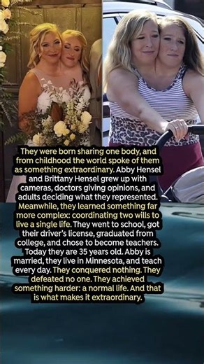 Abby and Brittany Hensel and the achievement of a normal life