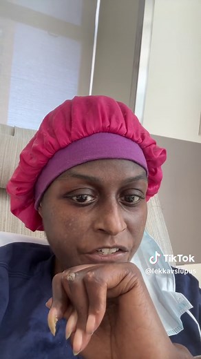 Understanding My Finger Condition as a Lupus Patient