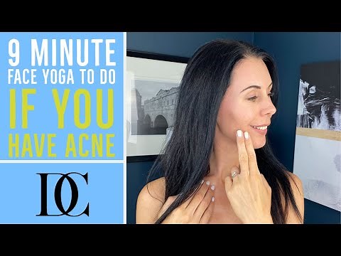 9 Minute Face Yoga To Do If You Have Acne