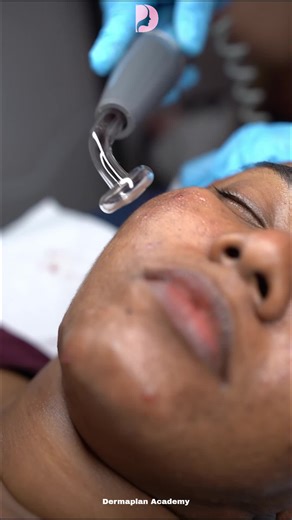 Transform Your Skin at Dermaplan Academy
