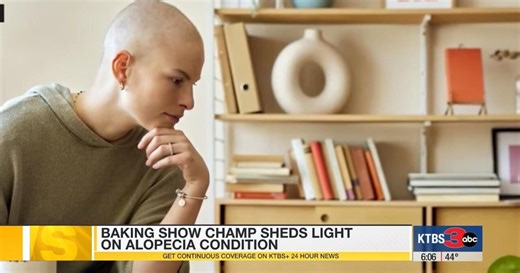 ‘Great British Baking Show’ star's platform highlights alopecia, inspires others