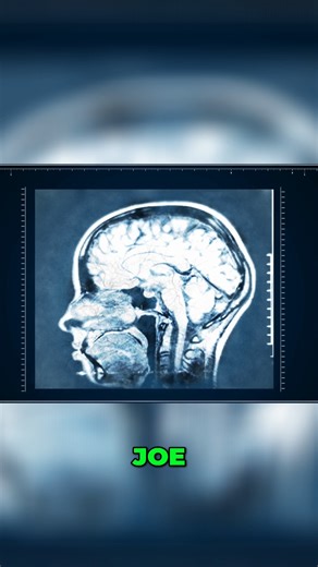 Invisible Disability: You Can't See My Brain Injury! A traumatic brain injury can change everything, even when no one else can see it. 🧠 Joe explains how living with an invisible disability affects daily life. From the outside, he looked “fine,” but the real damage wasn’t visible: cognitive changes, weakness, speech challenges, and the mental battle of accepting what others couldn’t see. Building purpose meant understanding his injury, educating those around him, and finding meaning inside the 
