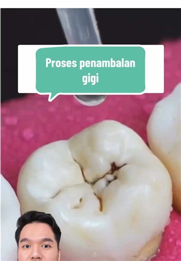 Proses Penambalan Gigi: Cara dan Tips Terbaik