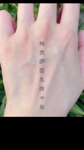 手の毛穴をなくす簡単な方法
