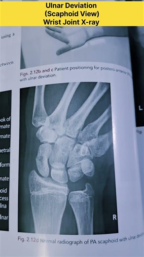 Wrist Joint X-ray || Scaphoid View #radiographerusn