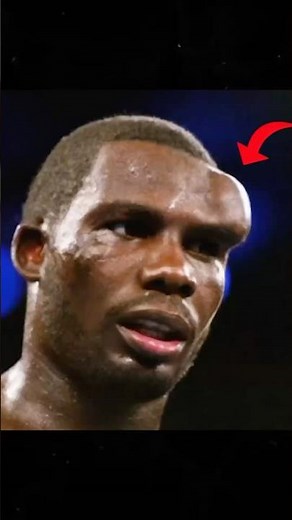 Worst injury in boxing history!