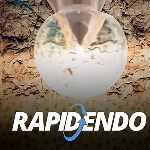 RAPID Endo Protocol Download