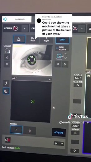 OCT y Cámara de Fundus: Examen Completo de Ojos