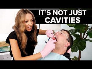 What Dentists REALLY Check at Your Dental Visit (It’s Not Just Cavities)