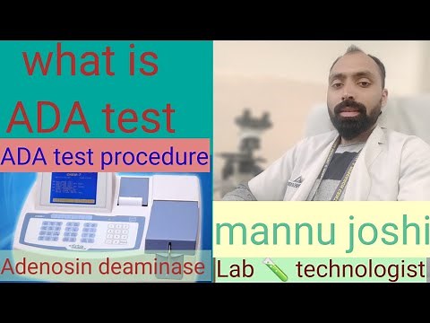 What is ADA / ADA test procedure/ adenosine deaminase