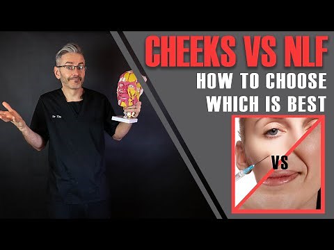 Cheeks Vs Nasolabial Folds. Is It True That Cheeks Make NLFs Redundant? [Aesthetics Mastery Show]
