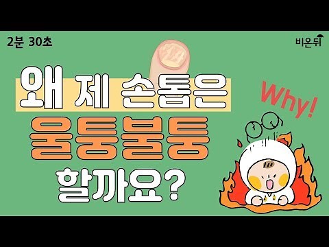 [2분30초] 울퉁불퉁한 내 손톱, 네일아트가 원인이라고?!