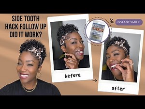 Side Tooth Hack Follow Up | Did it Work??- Instant Smile Temporary Tooth Kit