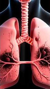What Air Pollution Actually Does to Your Lungs (URGENT) MedWithFardeen