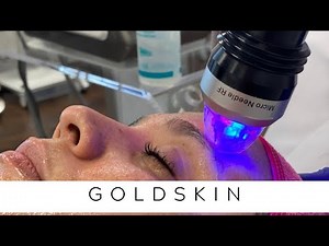 Goldskin | Microneedling & Fractional RF