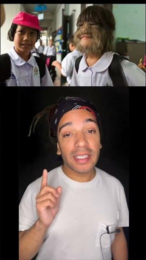 Syndrome Ambras : la femme la plus poilue du monde