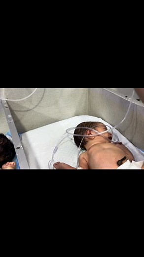 9.1K views · 98 reactions | Newborn Umbilical Cord Care: When & How to Remove the Clamp Safely#neonatologist #newborncare #cutebaby #baby #viralvideochallenge #newborn #newbornbaby #cute | Gautam Ashish | Facebook